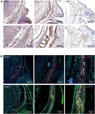 Hdac4 Regulates the Proliferation of Neural Crest-Derived Osteoblasts During Murine Craniofacial Development